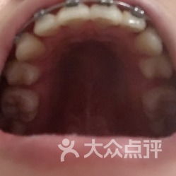 口腔健康無小事——走進華西口腔醫(yī)院的專業(yè)診療世界